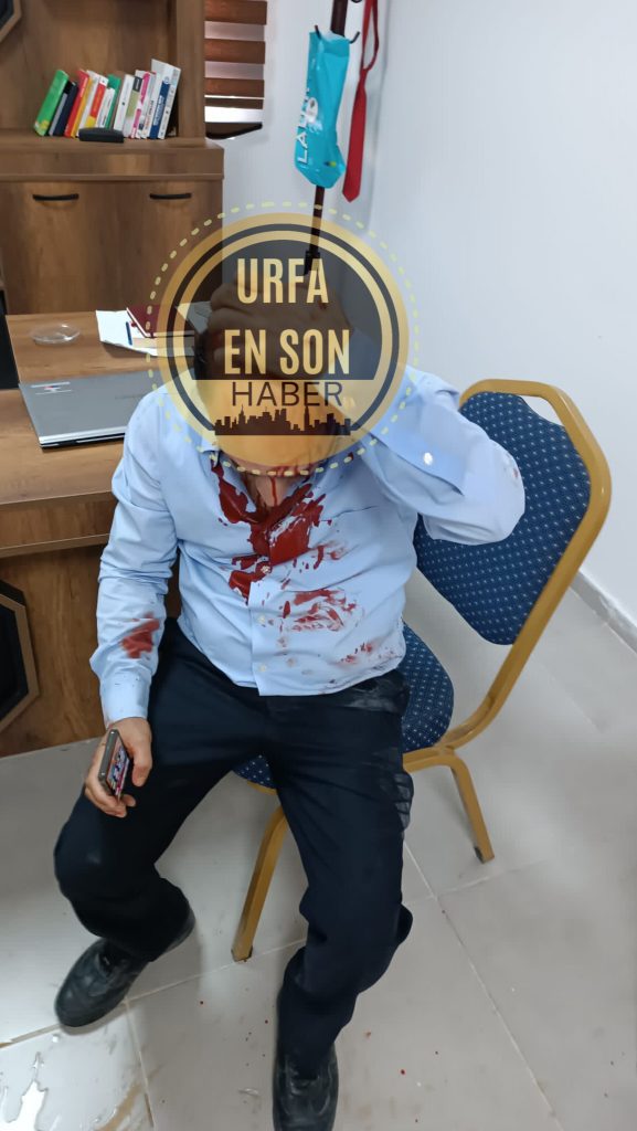 Şanlıurfa’da Okul Müdürü Saldırıya Uğradı