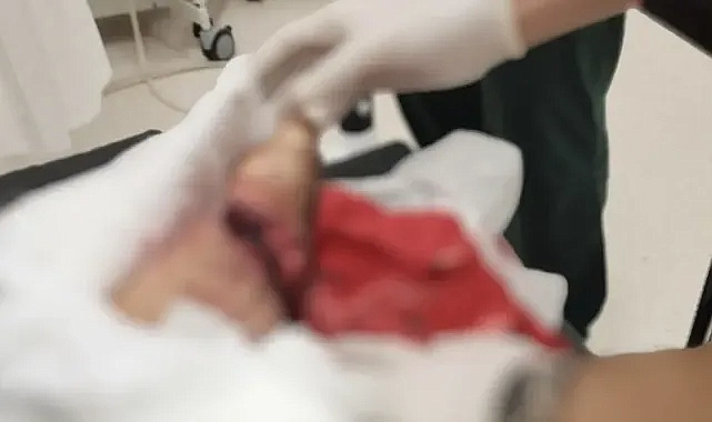 Urfa’da feci kaza! Ayağını kaptırdı