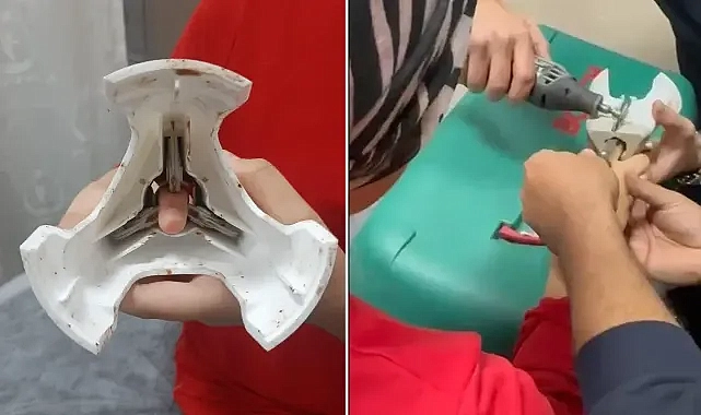 Urfa’da parmağı zeytin kesme makinesine sıkıştı! İtfaiye yardım etti!