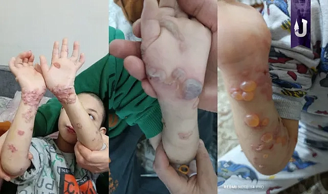 Şanlıurfa’da doktor eksikliği hayatları tehlikeye atıyor!