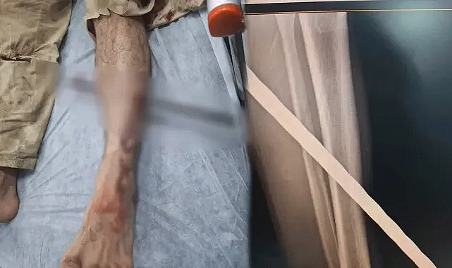 Şanlıurfa’da feci olay! İşçinin ayağına demir saplandı!