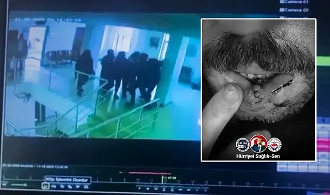 Sağlık çalışanlarına yönelik darp olayında Hürriyet Sağlık Sen’den tepki!